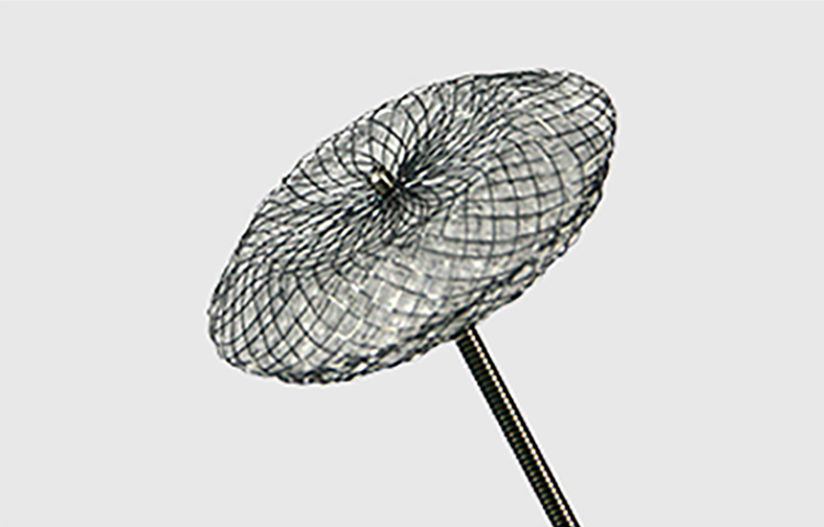 已售房缺封堵器的临床随访总结及风险受益统计分析报告 自2007年3月6日起连续100个进行手术的患者随访结果与统计分析报告